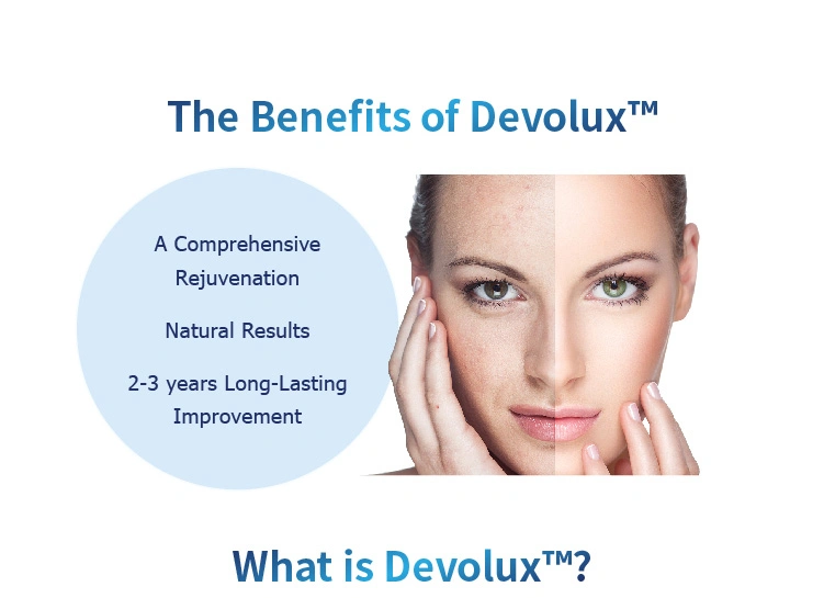 Devolux CE Approved Plla Poly-L-Lactic Acid Poly-L-Lact Relleno Injection